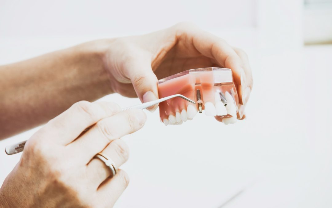 Fogászati műhiba esetbemutatás – implantátum elveszítése